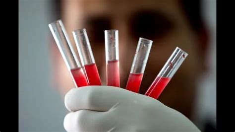 中国发现一例罕见的血型