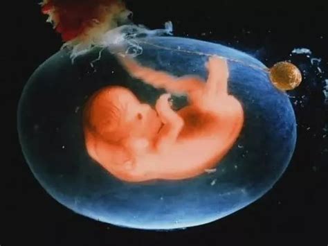 二十天的胚胎有多大