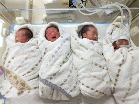 女子自然产下四胞胎