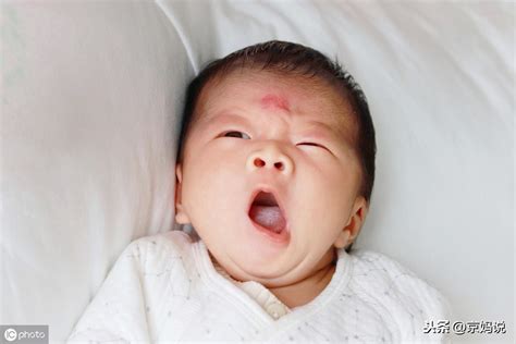 婴儿一岁半睡觉总是惊醒