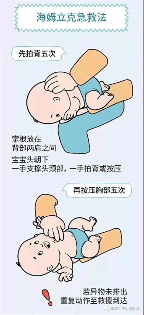 婴儿海姆立克急救法1-3岁图