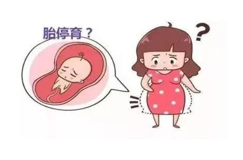 孕妇多少周容易胎停