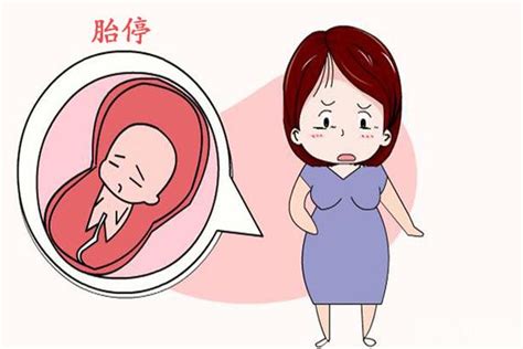 孕13周什么会引起胎停