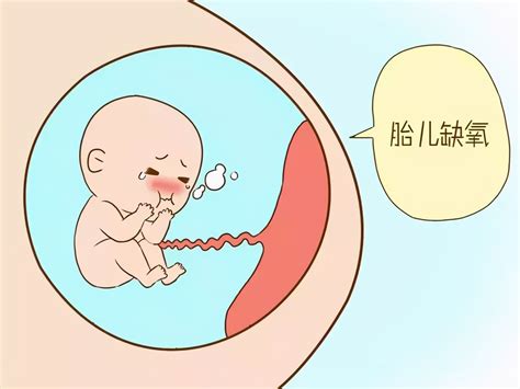 孕20周胎儿容易缺氧吗
