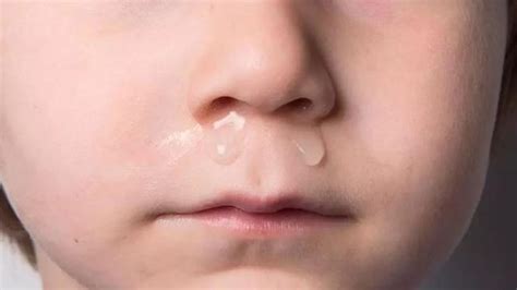 宝宝经常流鼻涕是什么原因导致的