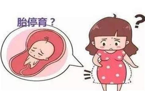 怀孕几个月胎停怎么回事