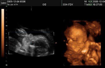 怀孕15周孩子缺氧啥感觉