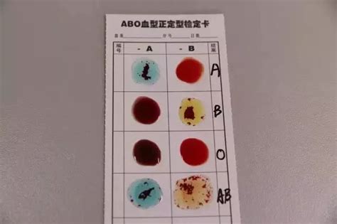 惠州检查血型