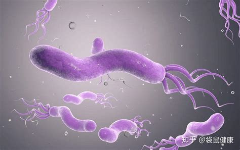感染全球一半人的幽门螺杆菌