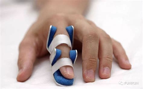 手指肌肉受伤怎么恢复