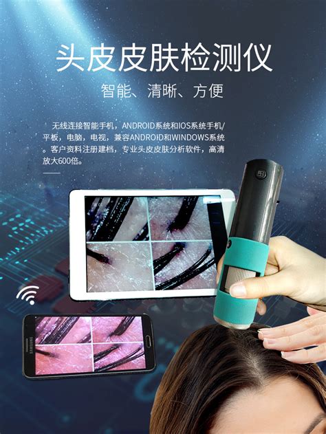 手机连接毛囊检测仪