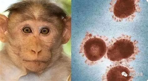 猴痘病毒在中国会有危险吗