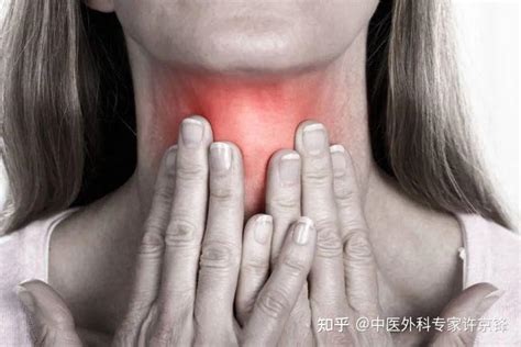 甲状腺会引起嗓子疼吗