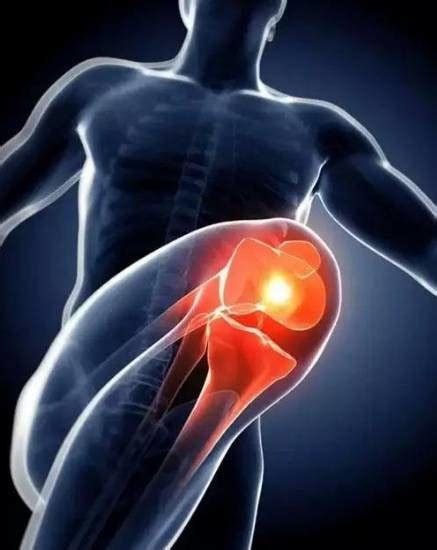 缓解膝关节疼痛用哪种护膝