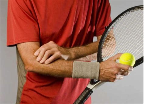 网球肘一般是什么样子