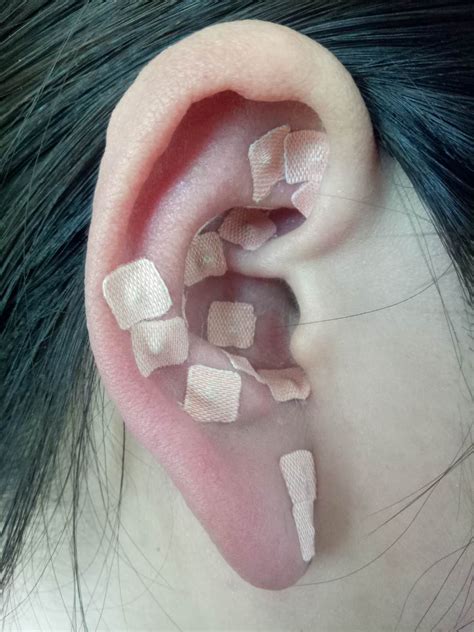 耳朵的养生疗法