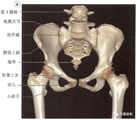 股骨头的位置示意图