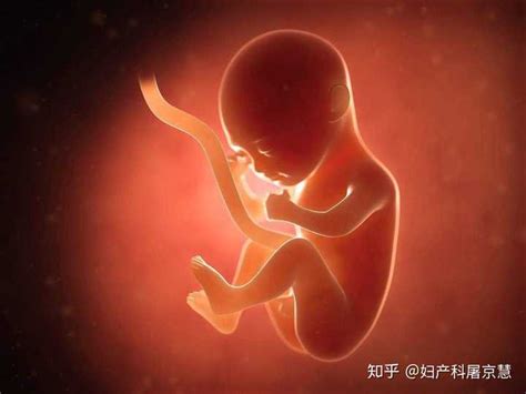 胎儿几个月开始有脐带绕颈