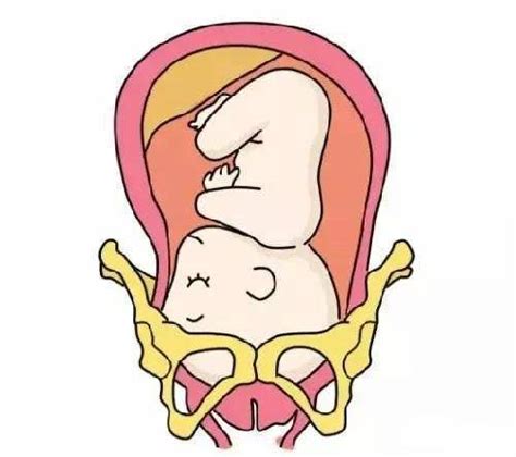 胎儿如何快速入盆