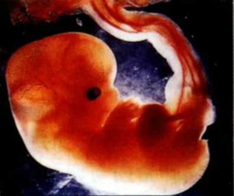 胚胎能判断发育时间吗
