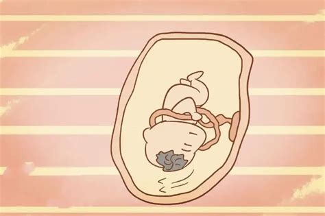 脐带绕颈一周怎么绕开孕中期