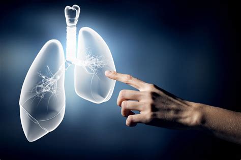 自测早期肺癌4个方法