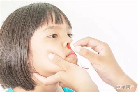 10岁流鼻血是什么病