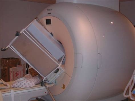 MRI事故