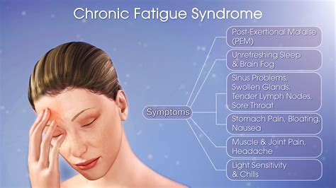symptoms of chronic fatigue